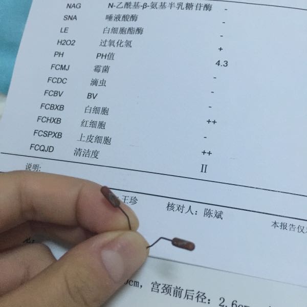 为何女性可以上环男性不可以结扎,上环一年了刺激出血有炎症