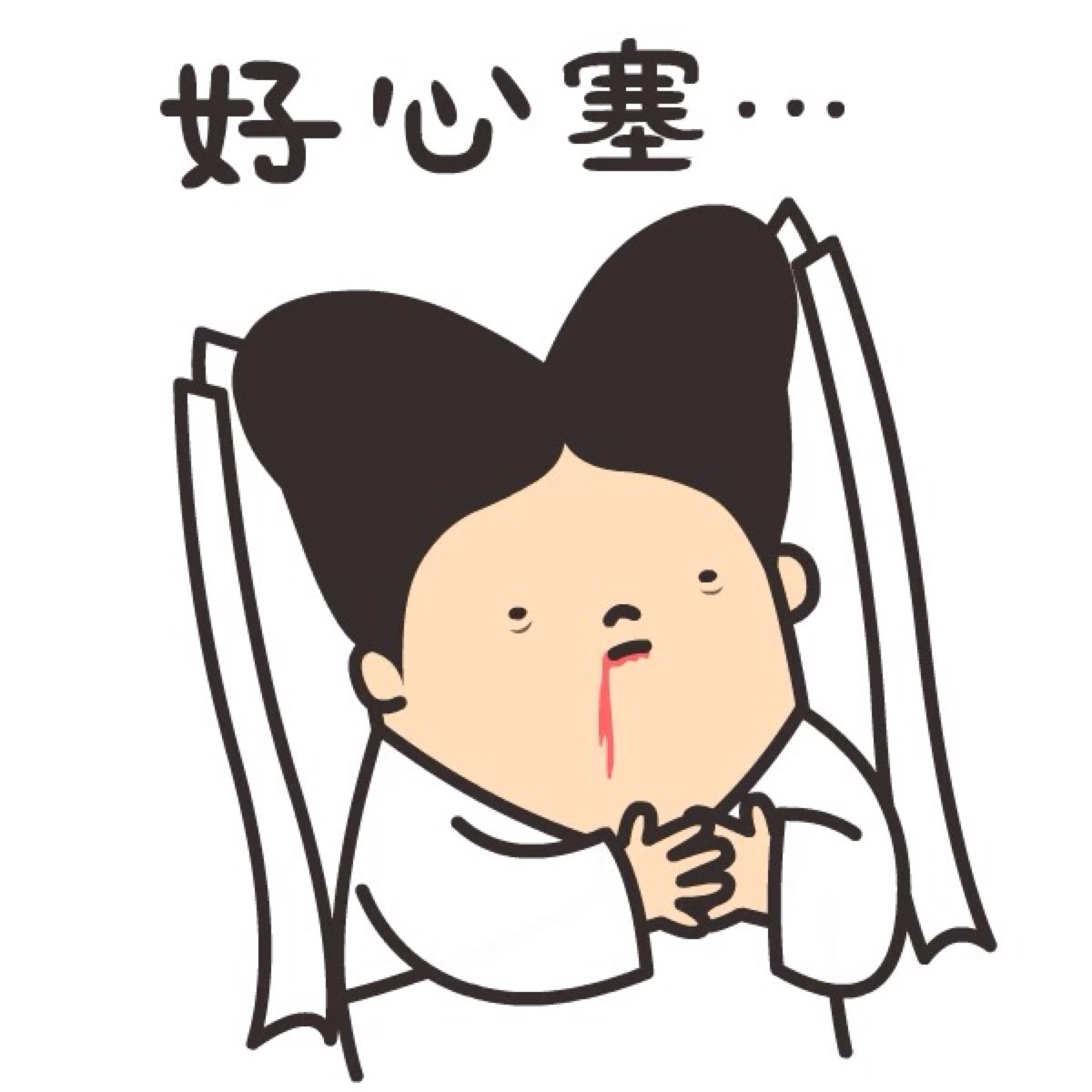 平行双眼皮割成了欧式双眼皮,割了个欧式双眼皮