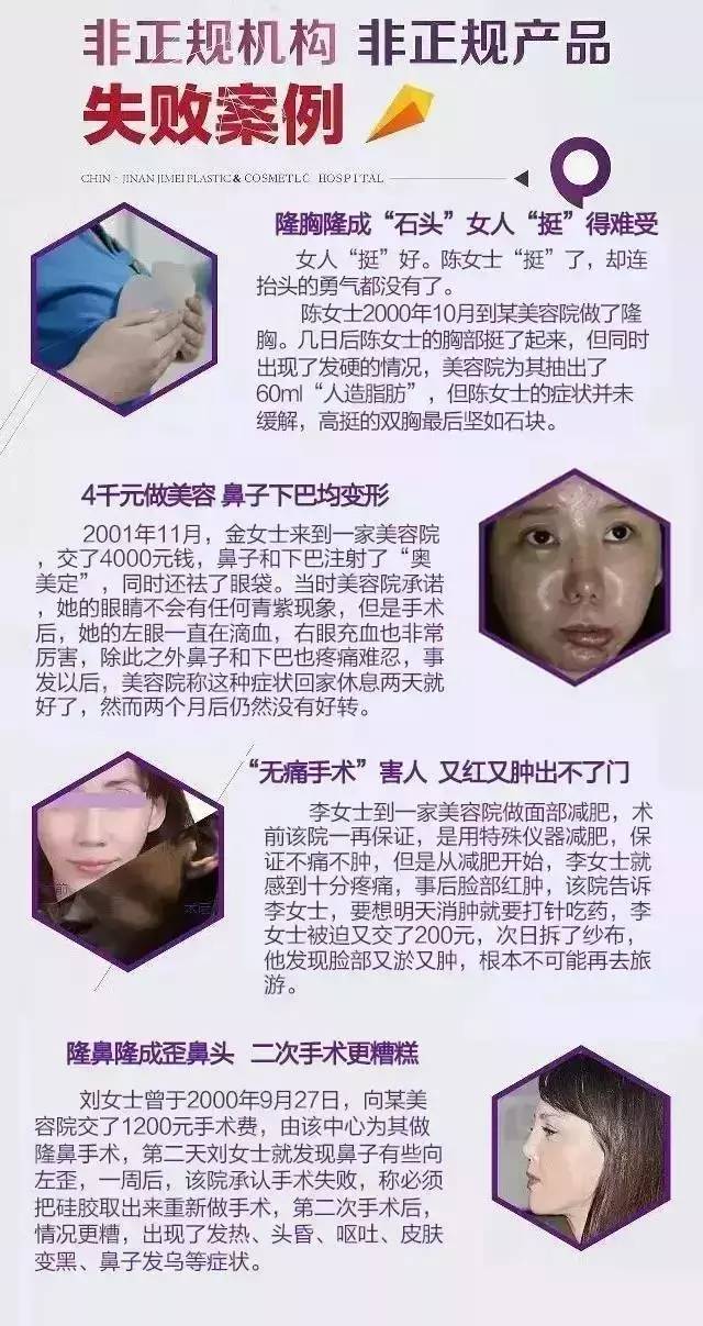 技术贴的正确贴法视频,技术贴如何快速撤下来