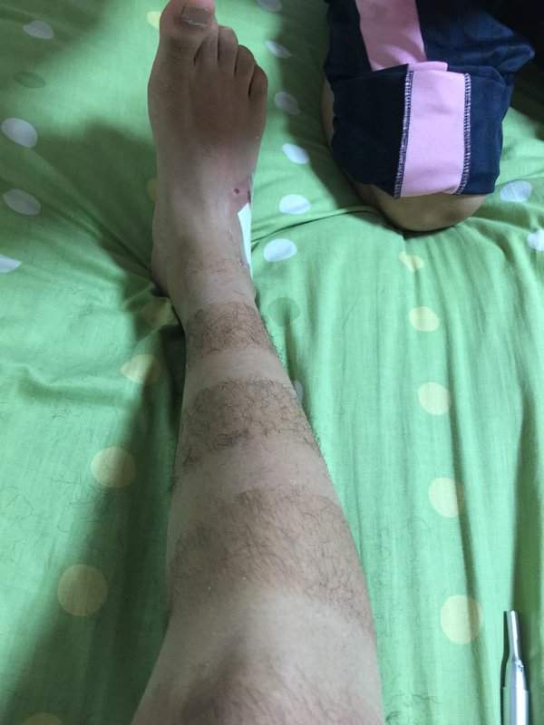 辣眼睛的特征,辣眼睛是如何回事