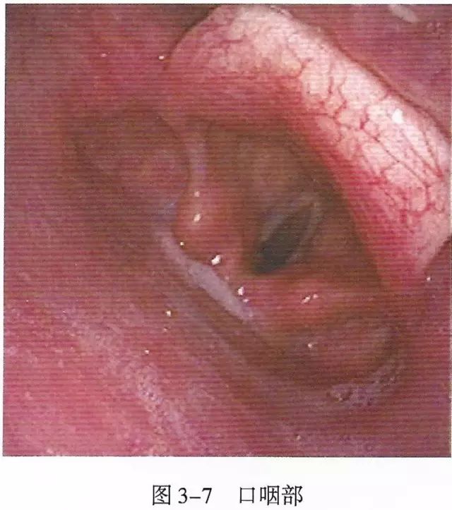 鍛煎惛閬撶殑瑙e墫缁撴瀯缁勬垚,涓嬪懠鍚搁亾瑙e墫瑙嗛鏁欑▼
