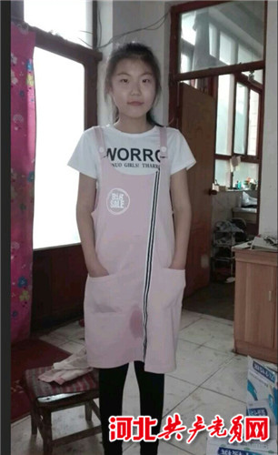 山东19岁女孩患红斑狼疮,系统性红斑狼疮女孩治疗费用