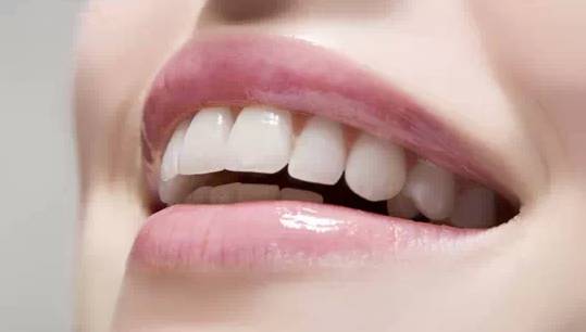 去除牙垢无需洗牙,无需洗牙五分钟消除牙垢