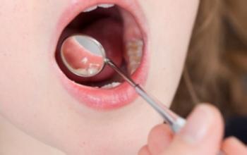 宝宝口腔溃疡怎么办有什么方法,宝宝口腔溃疡怎么办有什么妙招