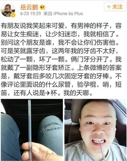 岳云鹏有牙套吗,小岳岳整牙