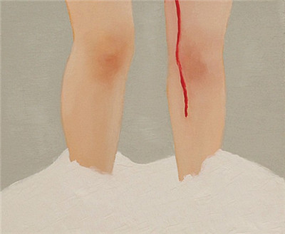 产后出血？产妇死亡的首要原因！究竟是为什么？