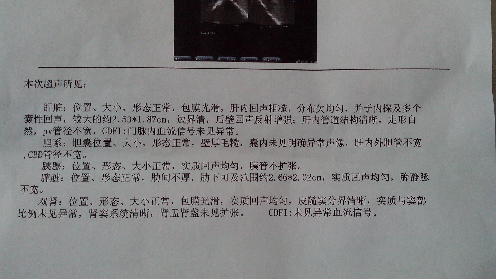 彩超单建议进一步检查代表什么,彩超检查结果会有误差吗