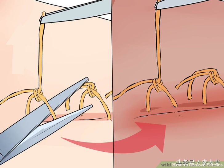 脑洞大开手术,脑洞大开手术后获得超能力