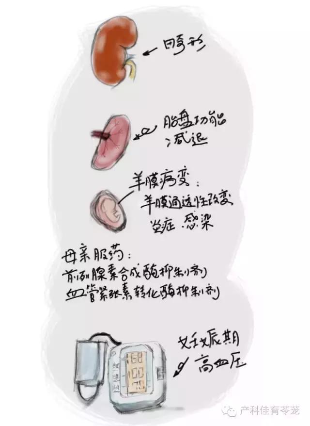 羊水过多和过少的原因,怎么预防羊水过多或过少