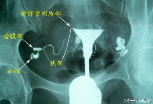 夫妻不孕不育检查项目及费用,夫妻双方检查不孕不育挂什么科