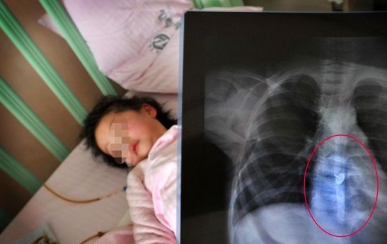 妈妈有事离开一会儿，9月大弟弟哭闹两岁姐姐误喂农药险丧命！