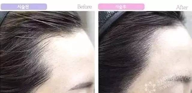 发际线多少适合露额头,露额头才是检验美女的第一标准