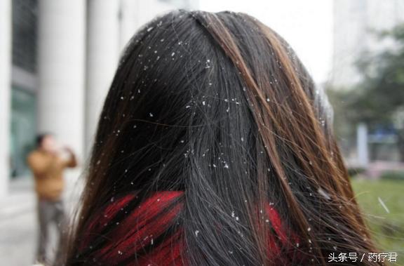 女生头屑去除减压过程,清理头屑女生