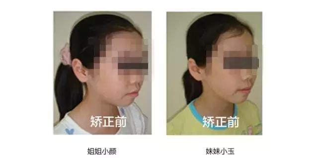 正畸专家介绍图,正畸医生关于整牙的10条建议