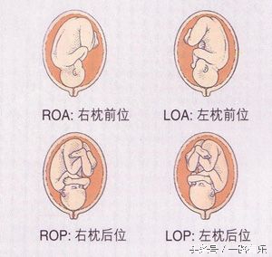 给你全面了解胎位知识，帮助选择分娩方式（上篇）