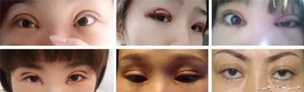 缇庝附鐒︾偣鏁村舰缇庡鍖婚櫌淇榧诲瓙,缇庝附鑱氱劍