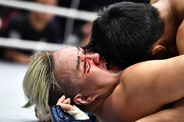 18赛季最新英雄强度排行榜,英雄联盟18八强