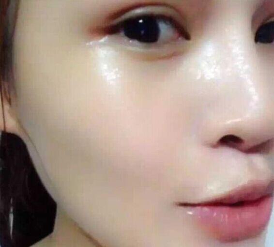 老师讲解祛斑技术的文案,祖传中医教你如何祛斑