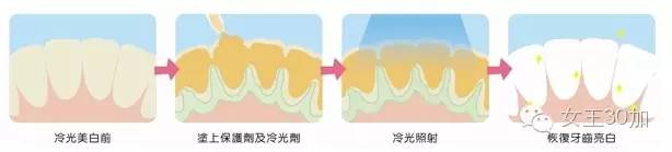 新美容|唇膏买嗨了,可你的牙配得上这些唇膏吗?