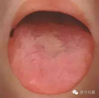 身体最健康舌头是怎么样的,健康人是什么体质