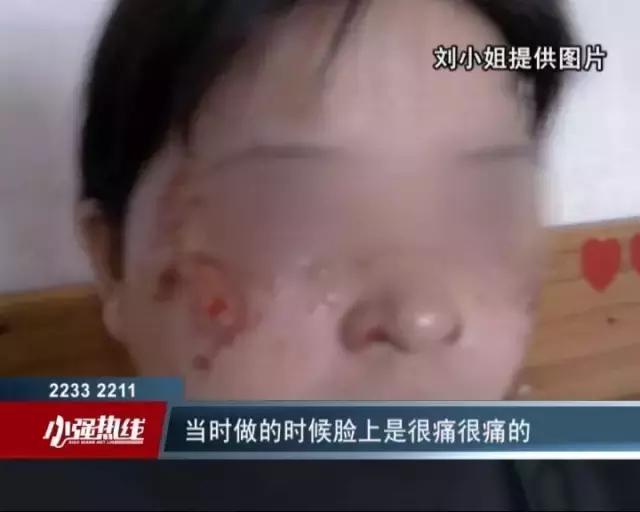 药水祛斑会癌变吗,药水祛斑的危害与效果