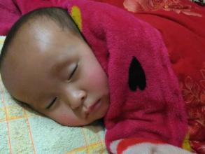 宝宝甲沟炎严重导致指甲剥离,宝宝甲沟炎需要剪指甲吗