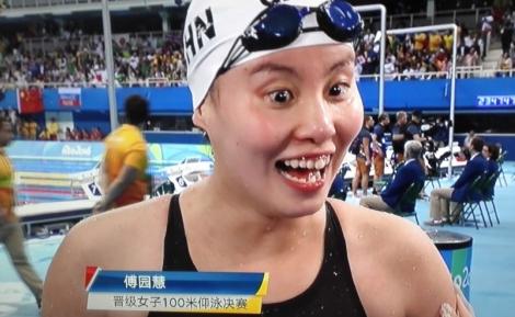 奥运明星都咋保养的？美体操选手靠面膜和泡澡