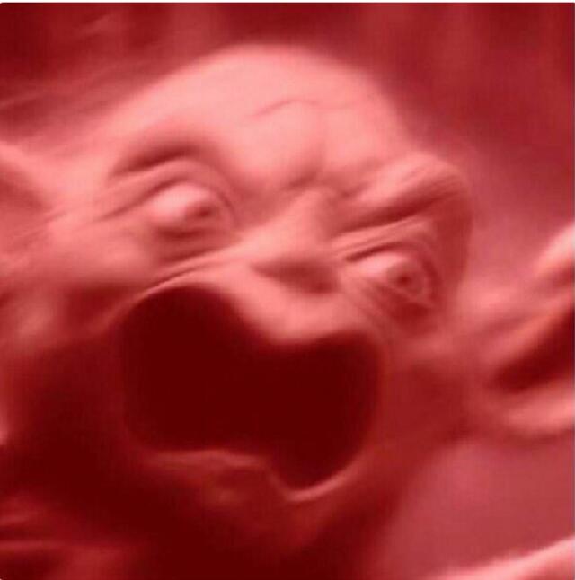 偏头痛的大实话,偏头痛症状知乎