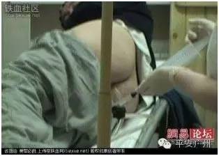 人体藏毒科普,人体藏毒有多厉害