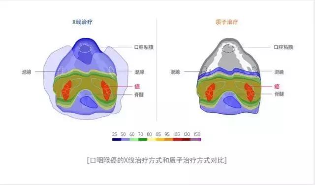 韩国三星医院治疗费用,首尔癌症医院