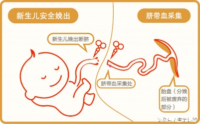 孕期大排查一般怎么做,胎儿双顶径直径