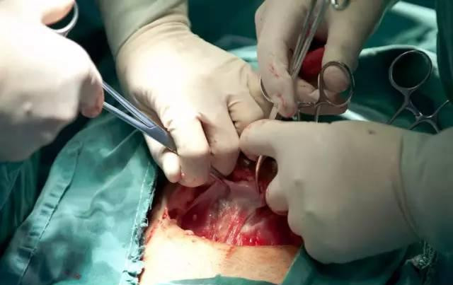 听说剖腹产更轻松？看看过来人怎么说！