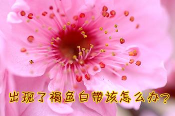 教你看懂白带常规,6秒教你看懂白带化验单