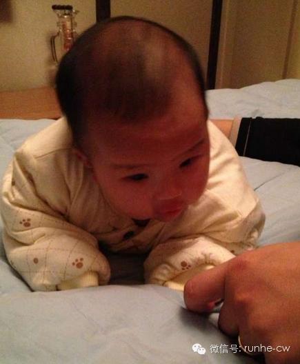 六个月宝宝小鸡皮前面发红肿了,宝宝小鸡皮前面发红发肿怎么办