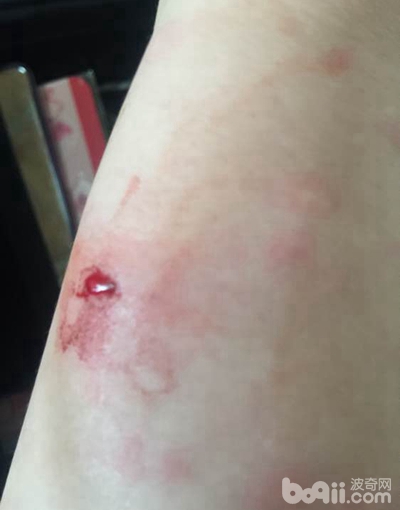 泰迪狗被二哈咬死,养了一条二哈