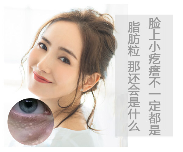 儿童脸上长一粒粒小疙瘩像脂肪粒,脸上类似脂肪粒的疙瘩是什么
