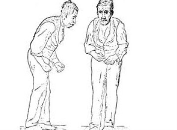 老人走路不稳怎么治疗,老人走路起步困难如何治疗