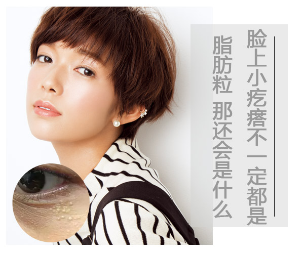 儿童脸上长一粒粒小疙瘩像脂肪粒,脸上类似脂肪粒的疙瘩是什么