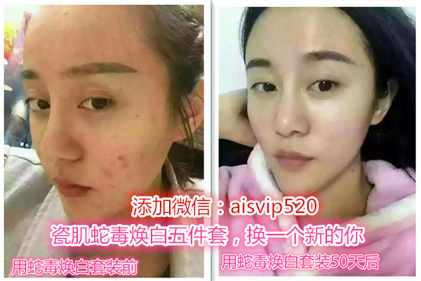 瓷肌去黑头产品好吗,瓷肌美白去黄去黑套装