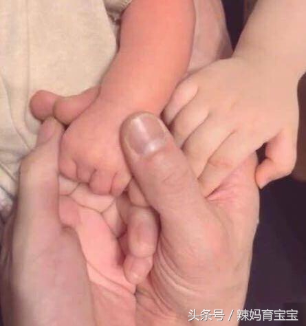 高龄产妇需要做产后修复吗,高龄产妇生孩子容易恢复吗