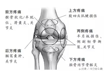 十大常见运动损伤部位及防治,运动损伤最容易出现部位