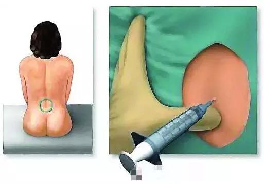 分娩抚摸肚子缓解疼痛,宝妈支招如何缓解分娩之痛