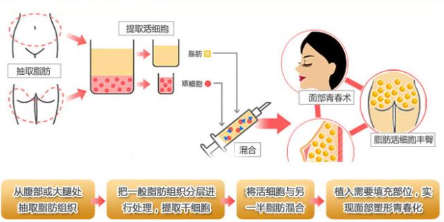 70后大叔秒变小姐姐,70后大叔变大嫂