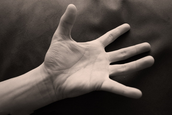 类风湿关节炎女早期症状能治好吗,类风湿关节炎早期典型症状是什么