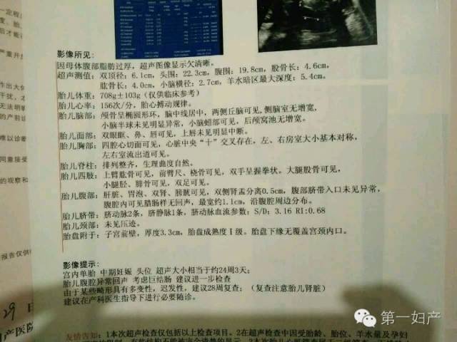 出生缺陷试题及答案,出生缺陷咨询干预培训考试及答案