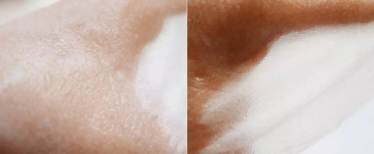 孕期敏感肌肤,孕期敏感肌用什么护肤品