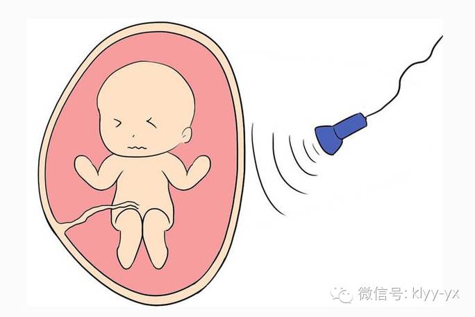 孕期检查B超单上的数据都代表什么呢？