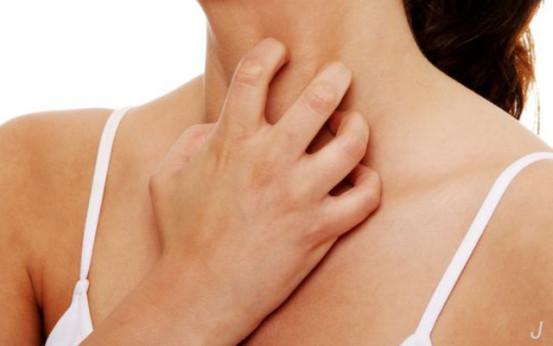 孕妈身体皮肤干燥怎么办,孕期冬季皮肤干燥瘙痒怎么办