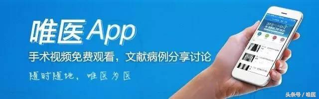 桡骨远端骨折传统石膏打法,成人桡骨远端骨折诊疗指南2023版