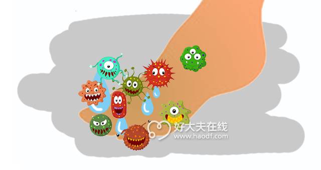 3个小妙招永久去除脚臭,脚臭不敢脱鞋赶紧试试这招